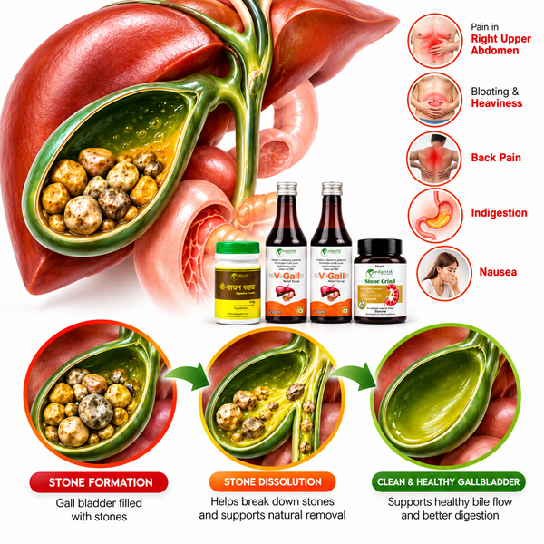 1-Month Gall Bladder Stone Care Wellness Course – Ayurvedic Medicine