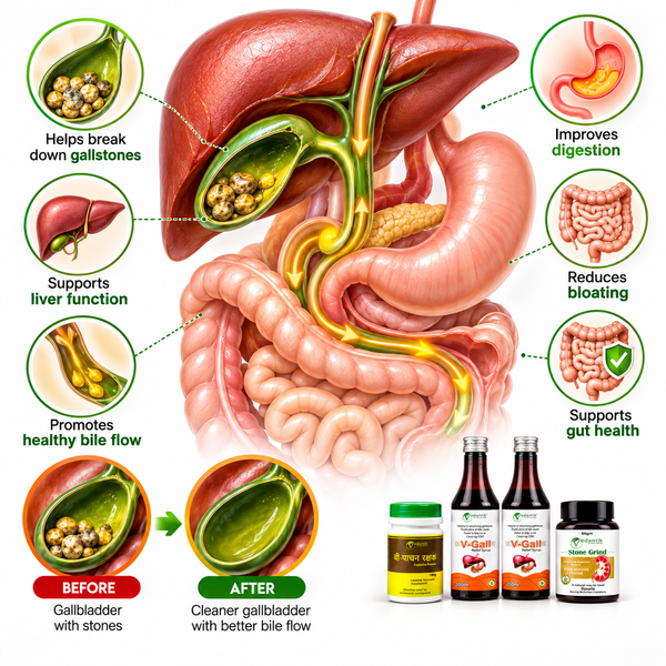 1-Month Gall Bladder Stone Care Wellness Course – Ayurvedic Medicine